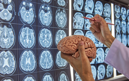 Science Talk: Jak data mění epileptochirurgii: od lokalizace k&nbsp;fenotypům (online)