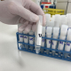 Laboratoř FNUSA začala vyhodnocovat „žvýkačkové“ PCR testy ze škol